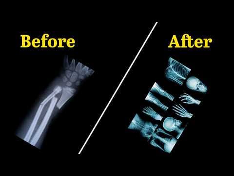 X-Rays Revision — Modern Physics Lec 03